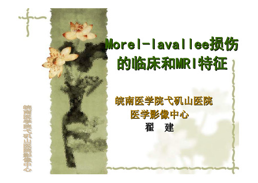 Morel-Lavallee损伤的临床和MRI特征