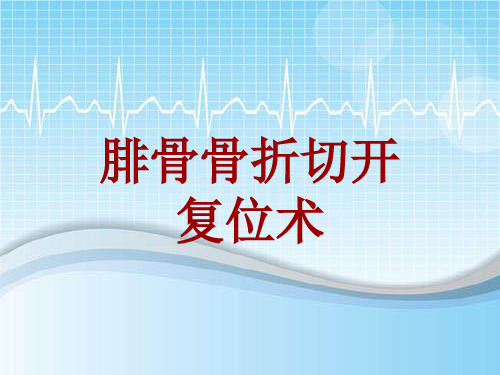 外科手术教学资料：腓骨骨折切开复位术讲解模板