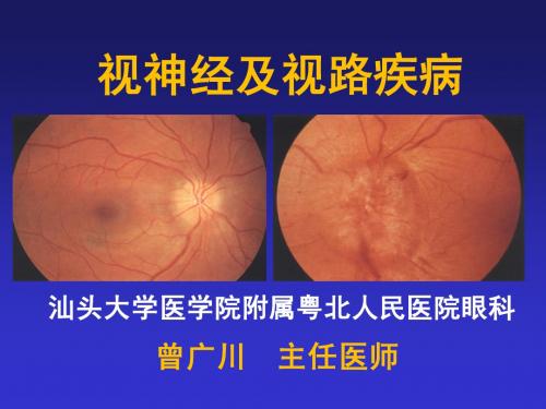 视神经及视路疾病
