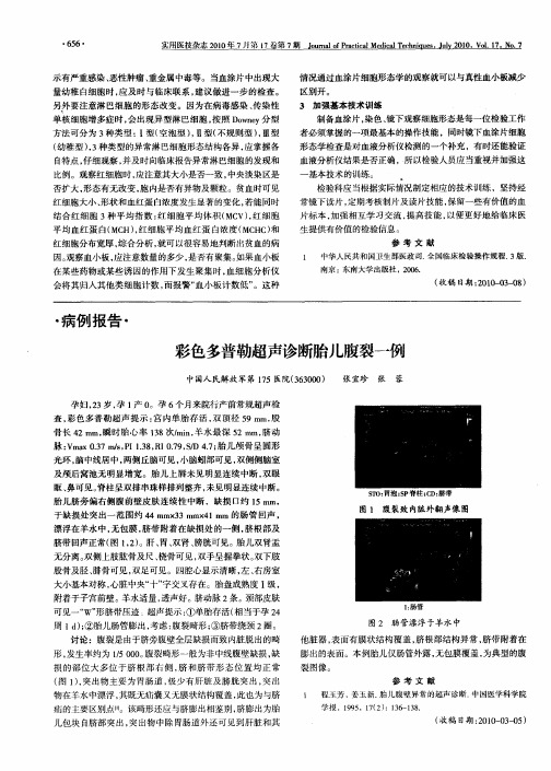 彩色多普勒超声诊断胎儿腹裂一例