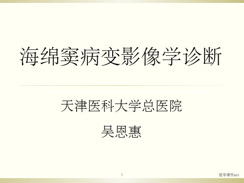 海绵窦病变影像学诊断