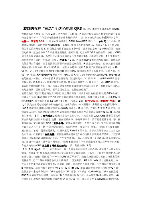 心电图QRS波群的五种