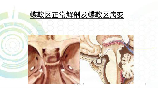 蝶鞍区正常解剖及蝶鞍病变课件