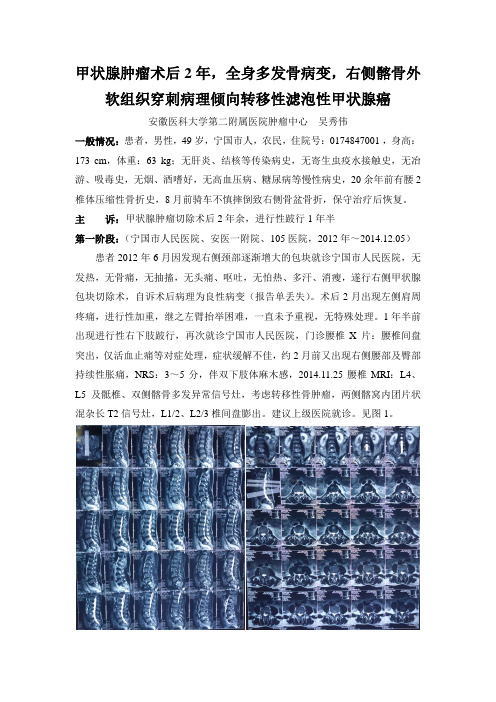 甲状腺肿瘤术后2年,全身多发骨病变,右侧髂骨外软组织穿刺病理倾向转移性滤泡性甲状腺癌