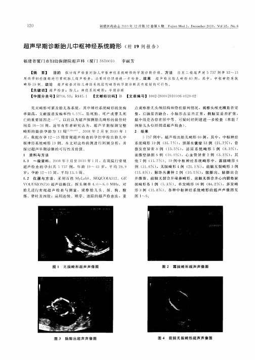 超声早期诊断胎儿中枢神经系统畸形(附19例报告)