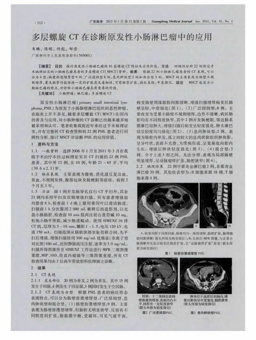 多层螺旋CT在诊断原发性小肠淋巴瘤中的应用