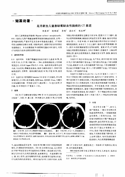 足月新生儿窦息缺氧缺血性脑病的CT表现
