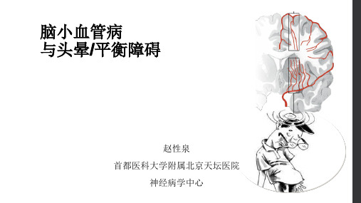 脑小血管病与头晕及平衡障碍
