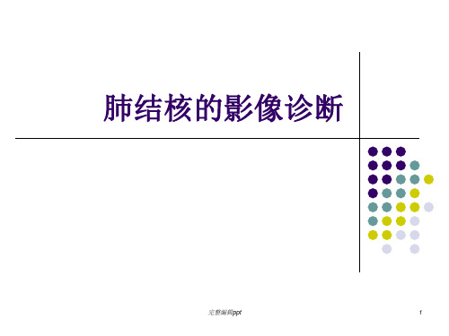 肺结核的影像诊断(X线)ppt精选课件