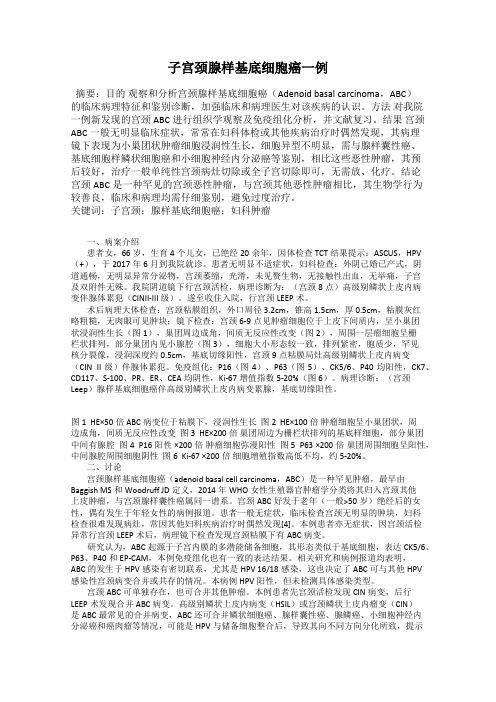 子宫颈腺样基底细胞癌一例