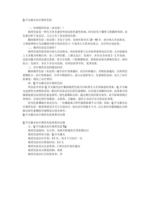 Q开关的作用