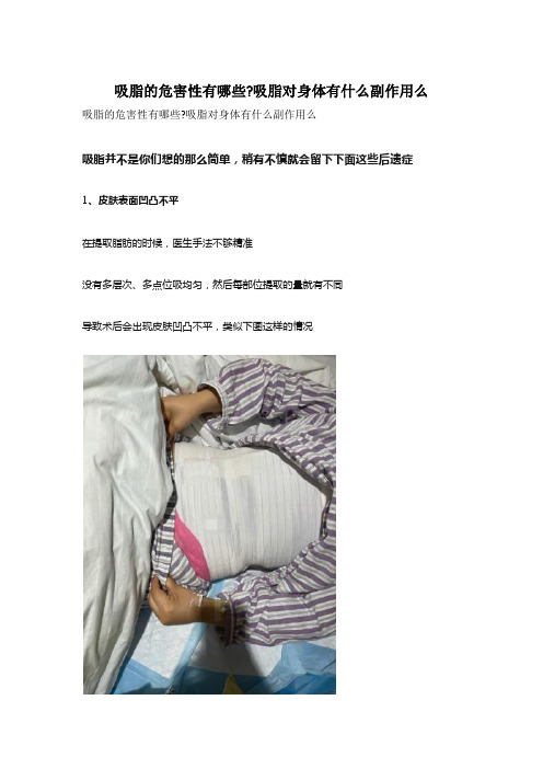 吸脂的危害性有哪些吸脂对身体有什么副作用么