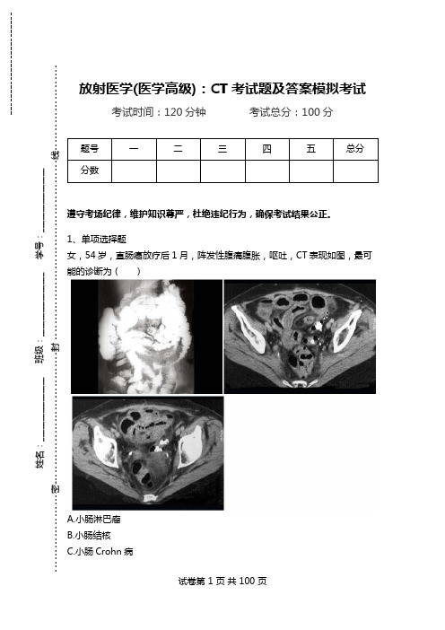 放射医学(医学高级)：CT考试题及答案模拟考试.doc