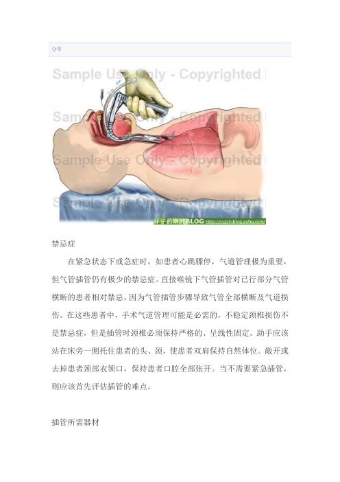 气管插管规范(《新英格兰杂志》)——