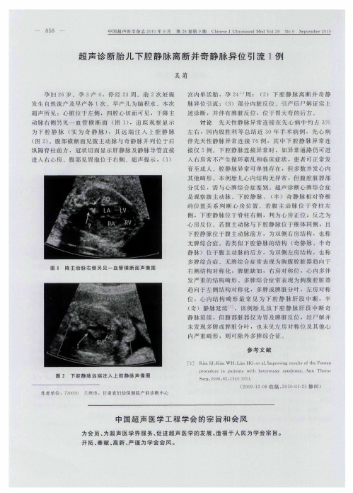 超声诊断胎儿下腔静脉离断并奇静脉异位引流1例
