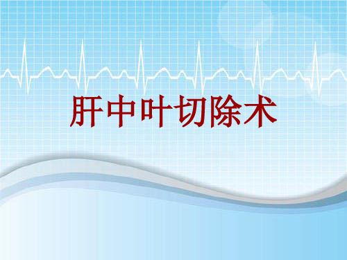 手术讲解模板：肝中叶切除术