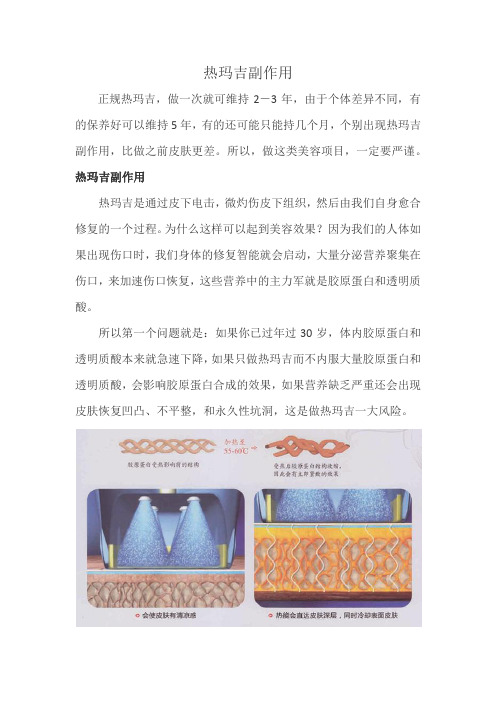 热玛吉副作用