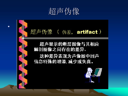 超声伪像