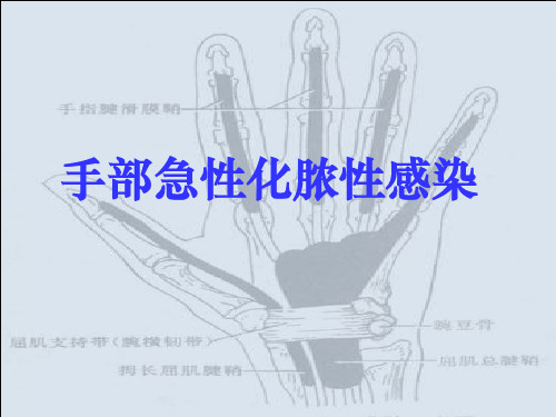 手部的化脓性感染ppt课件