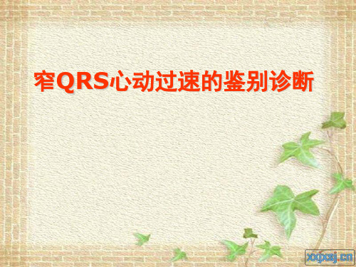 窄QRS心动过速的鉴别诊断
