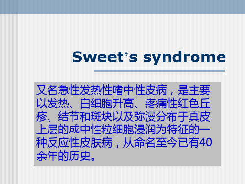 SWEET’S_综合征   OK概述