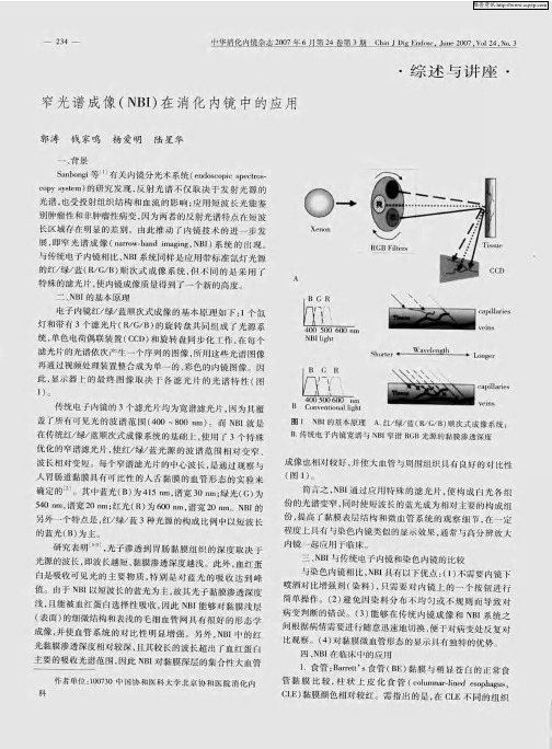 窄光谱成像(NBI)在消化内镜中的应用