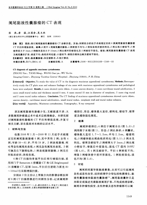 阑尾黏液性囊腺瘤的CT表现