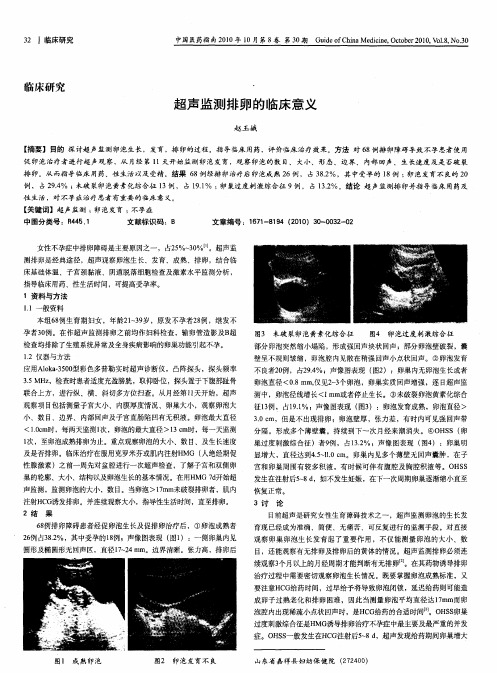 超声监测排卵的临床意义
