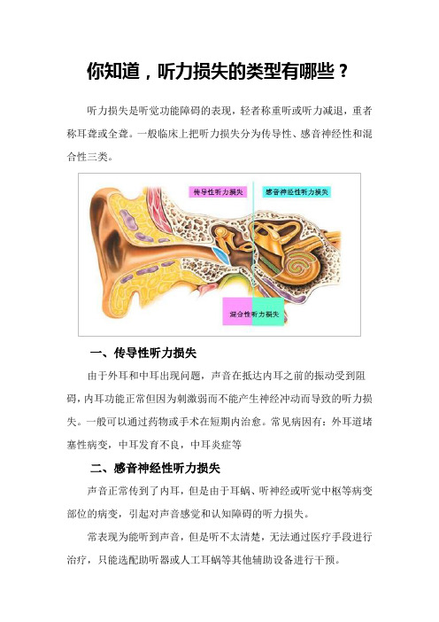你知道,听力损失的类型有哪些？