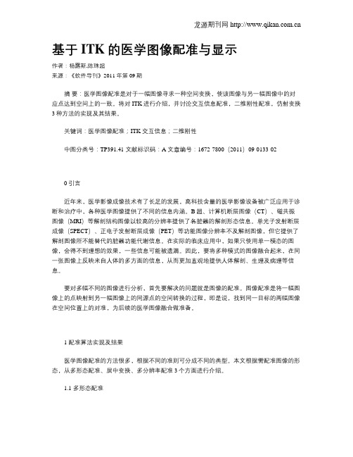 基于ITK的医学图像配准与显示