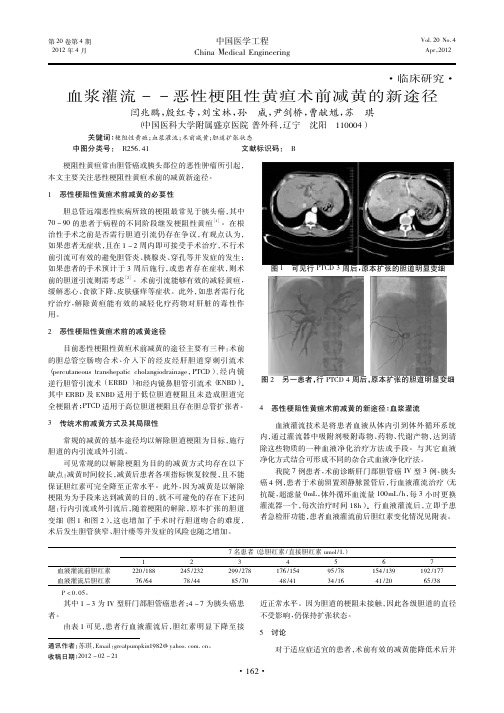 血浆灌流——恶性梗阻性黄疸术前减黄的新途径