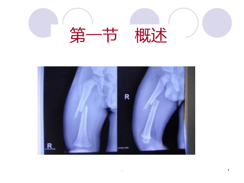 章骨折病人的护理PPT课件
