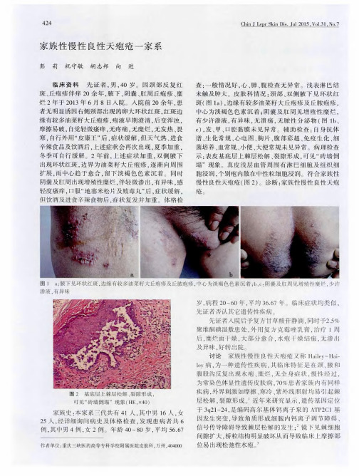 家族性慢性良性天疱疮一家系