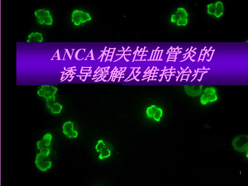 ANCA相关性血管炎的诱导缓解及维持治疗进展