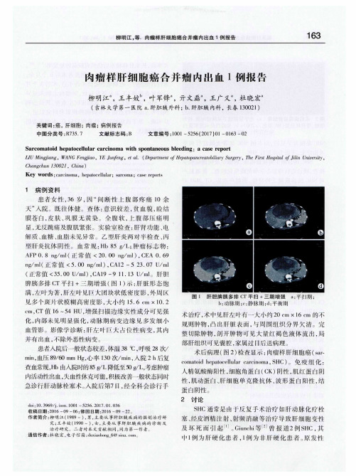 肉瘤样肝细胞癌合并瘤内出血1例报告