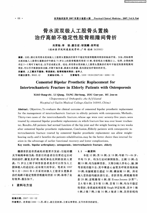 骨水泥双极人工股骨头置换治疗高龄不稳定性股骨粗隆间骨折