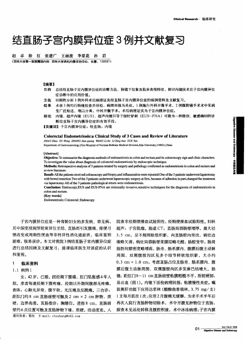 结直肠子宫内膜异位症3例并文献复习
