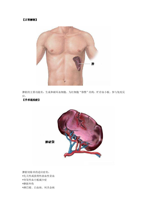 脾切除术