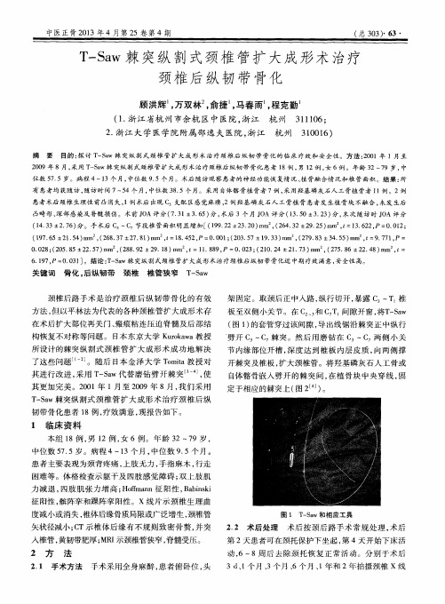 T—Saw棘突纵割式颈椎管扩大成形术治疗颈椎后纵韧带骨化