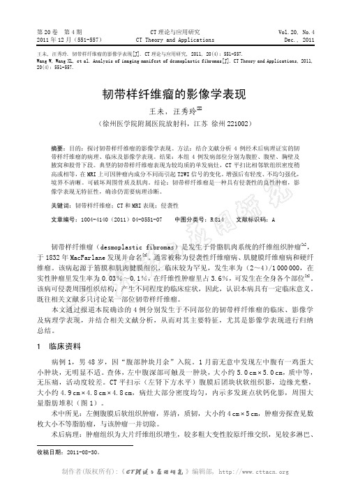 韧带样纤维瘤的影像学表现