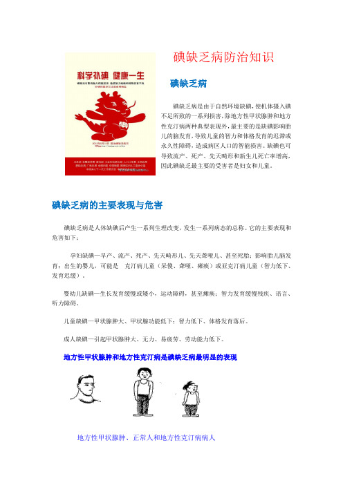 碘缺乏病防治知识