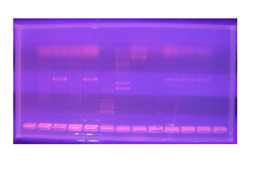 生物技术实验-研究生课程-DNA的凝胶电泳