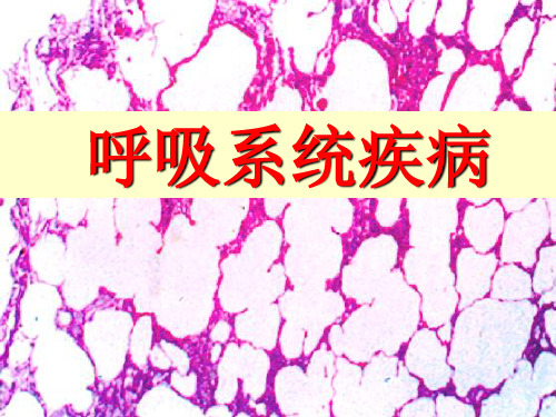 慢支、肺气肿、肺心病