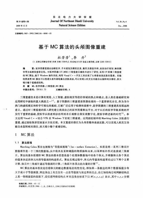 基于MC算法的头颅图像重建