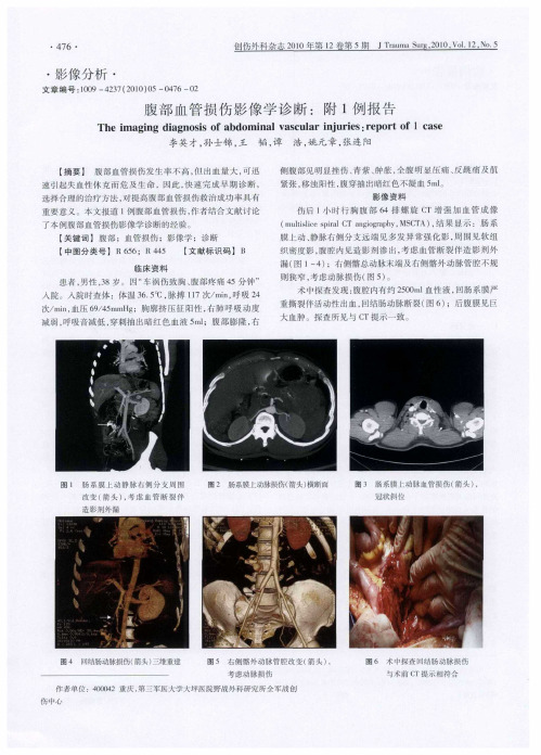 腹部血管损伤影像学诊断：附1例报告