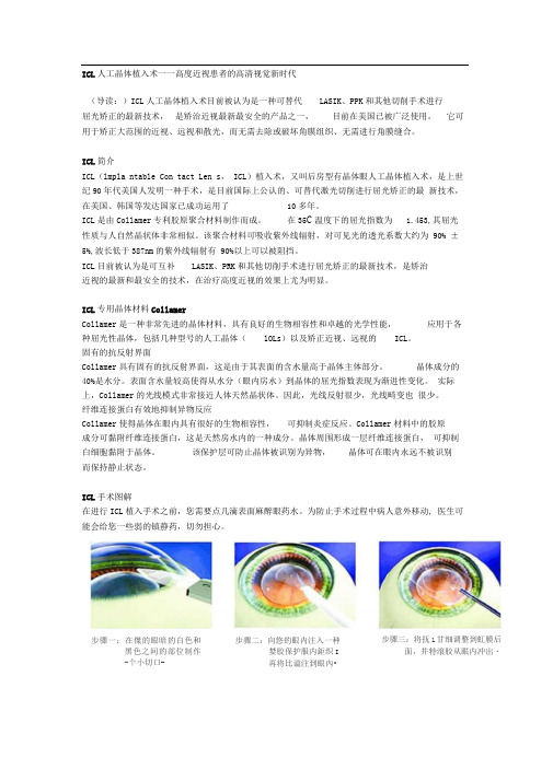 ICL人工晶体植入术——高度近视患者的高清视觉新时代