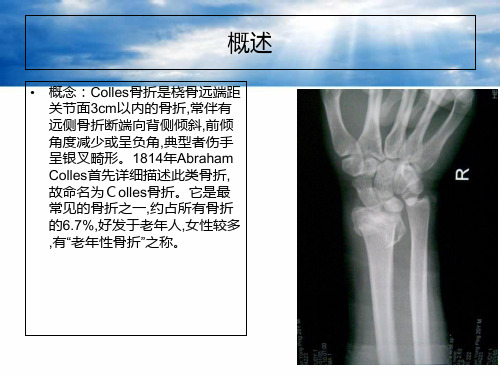 桡骨远端骨折COLLES骨折概述-PPT课件