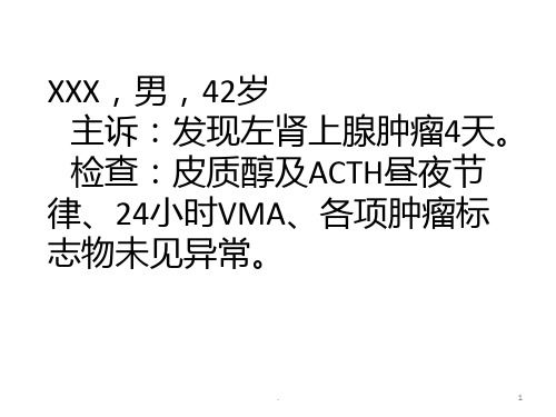 腹膜后平滑肌肉瘤讨论ppt课件