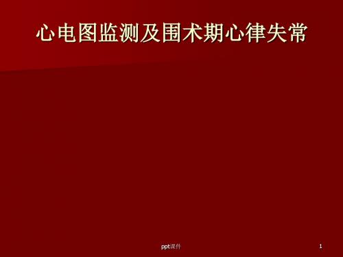 心电图监测及围术期心律失常  PPT课件