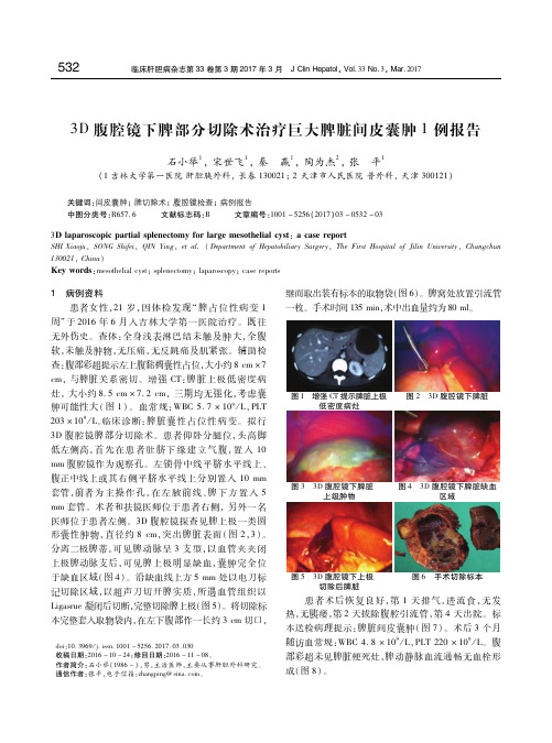 3D腹腔镜下脾部分切除术治疗巨大脾脏间皮囊肿1例报告 石小举